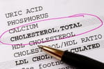 Le "bon" cholest&eacute;rol remis en question