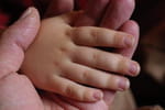Les maladies g&eacute;n&eacute;tiques du b&eacute;b&eacute; influenc&eacute;es par l'&acirc;ge du p&egrave;re