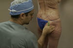 Les fesses : nouvelle obsession des Californiennes