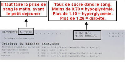 la glycémie se mesure généralement à jeun.