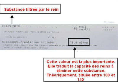 une créatinine élevée peut indiquer un problème rénal.