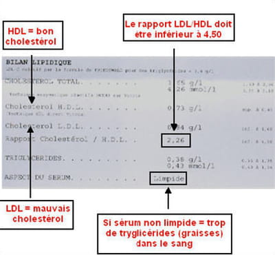 ne pas confondre hdl et ldl cholestérol.