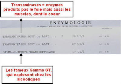 des enzymes élevés peuvent refléter une pathologie mais aussi, tout simplement,
