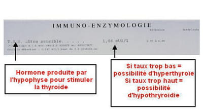 le dosage de tsh permet de détecter un éventuel problème de thyroïde.
