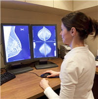 le dépistage organisé permet une double lecture des mammographies.