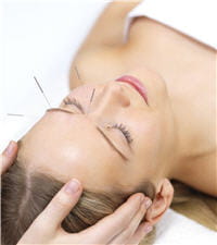 l'acupuncture peut aider à faire face aux crises de migraine, en complément de