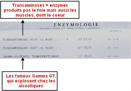 des enzymes élevés peuvent refléter une pathologie mais aussi, tout simplement,